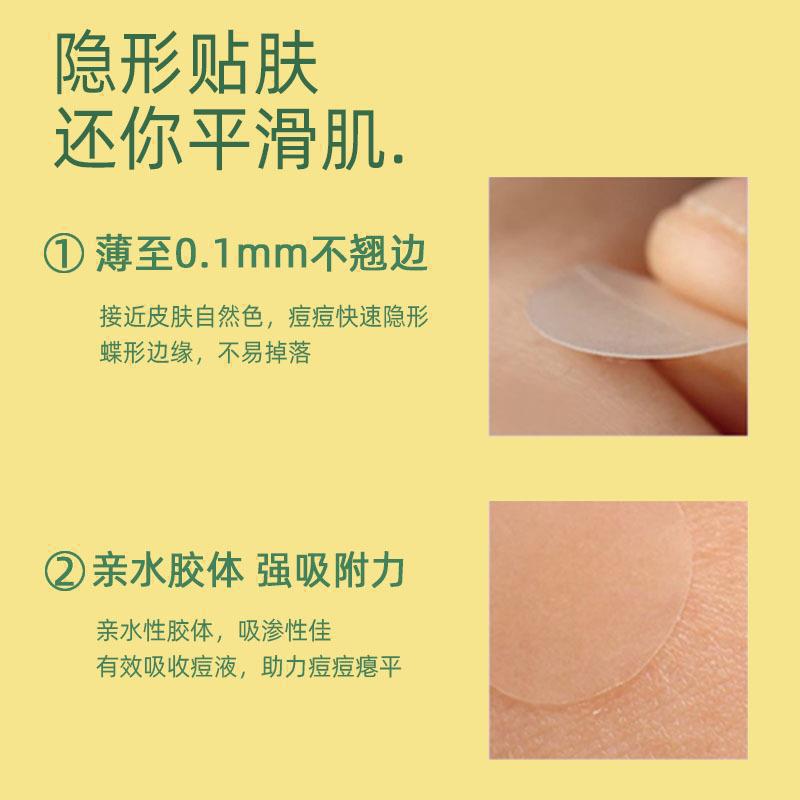 Vt Tiger Acne Patch Has the Same Style as Cica to Eliminate Pus Inflammation, First Aid to Remove Acne, Invisible Patch for Students, Affordable and Authentic