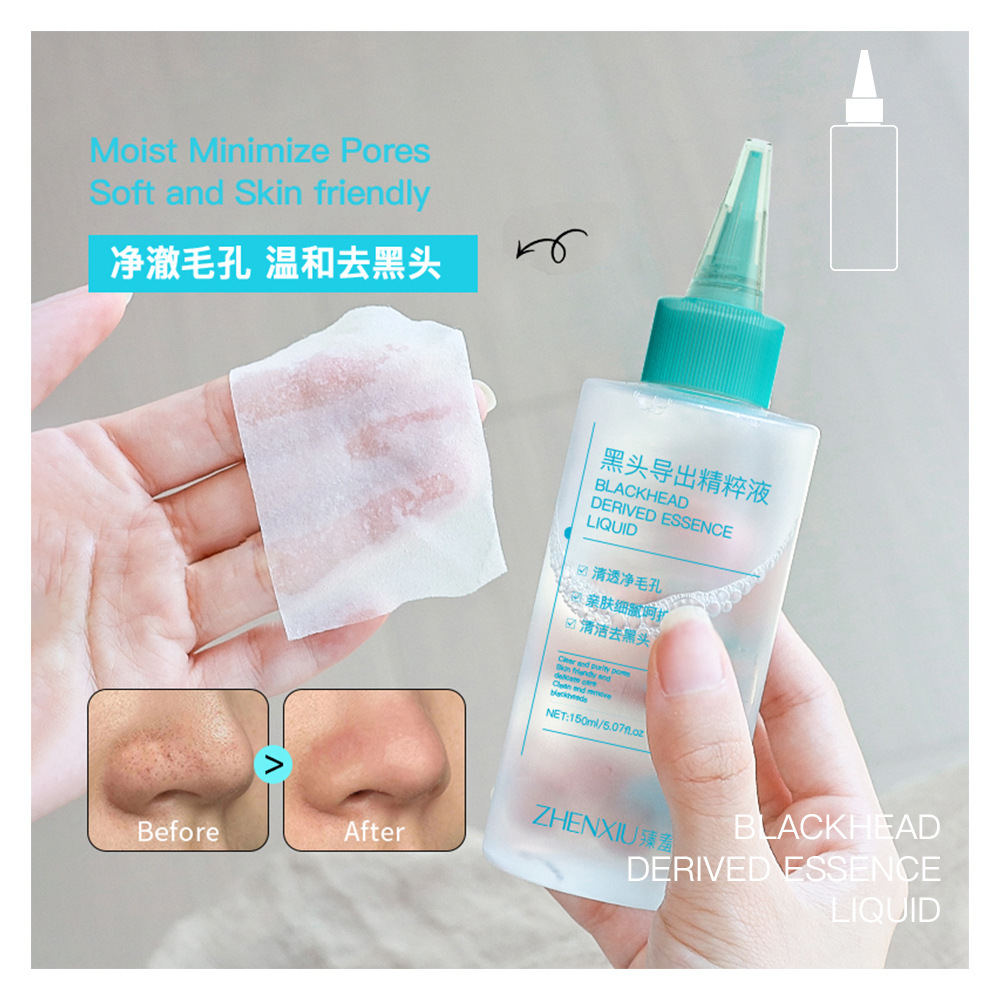 Zhen Shame Blackhead Export Essence Shrink Pore and Blackhead Egg-removing Water 150ml Wet Cotton Facial Repair Solution