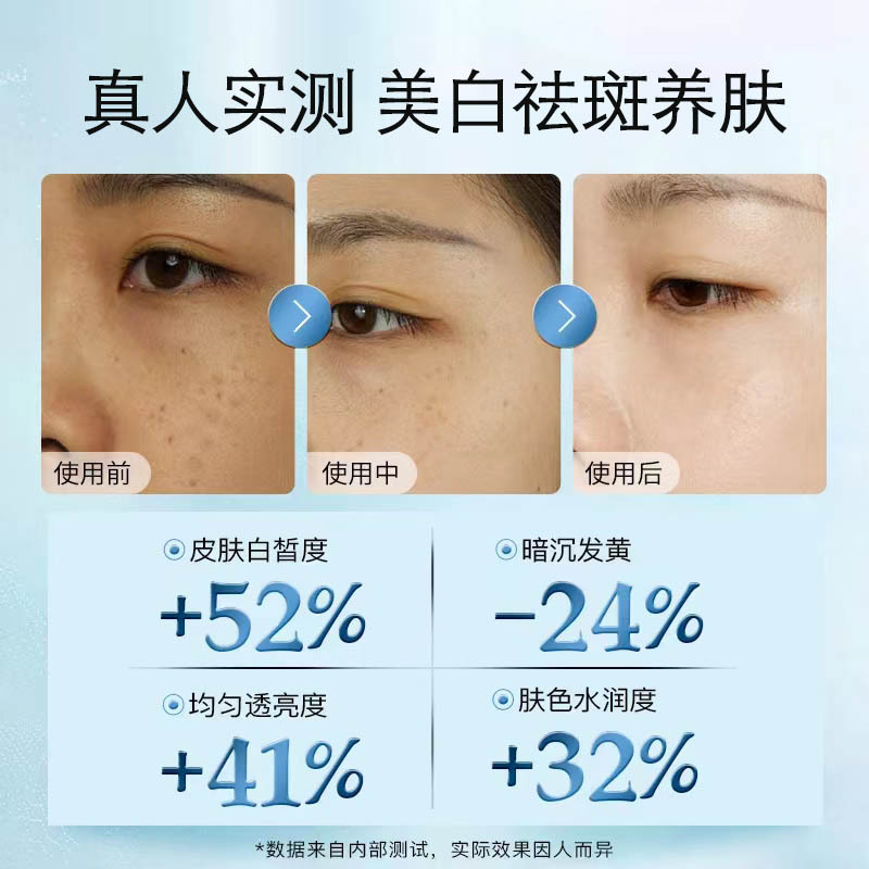 Beauty Salon Whitening Anti-Freckle Cream Desalination Spot Removal Cream Sunspots, Freckles, Chloasma, Age Spots Cream