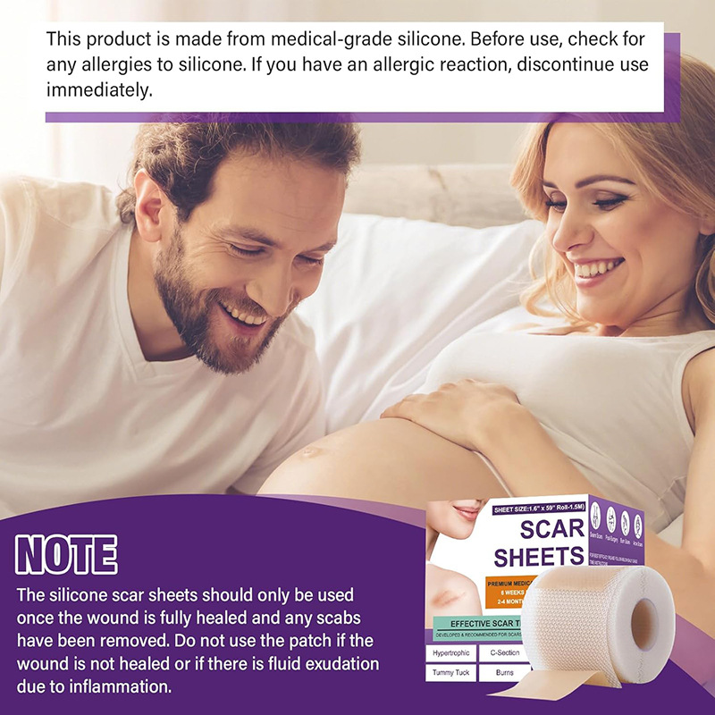 Cross-Border Skin Care Silicone Scar Removal Strips Soothes Skin Scars, Fever and Scald Skin Scars Cream