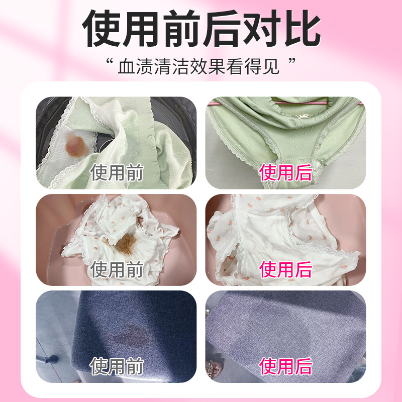 Protease blood stain cleaning dry cleaning agent to stubborn menstruation menstruation blood stain cleaning agent bed sheet underwear to remove blood stain cleaning