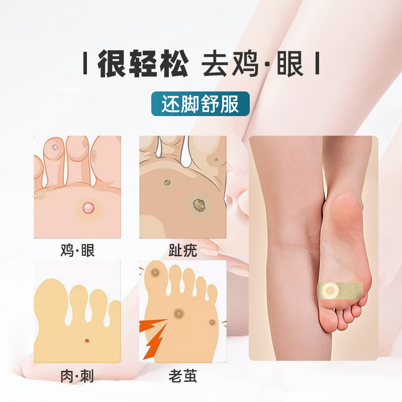 Foot Care Chicken Eye Patch Plaster Manufacturer Wholesale Ointment to Remove Foot Patch Anti-itch Chicken Eye Patch 6 Patch om Generation