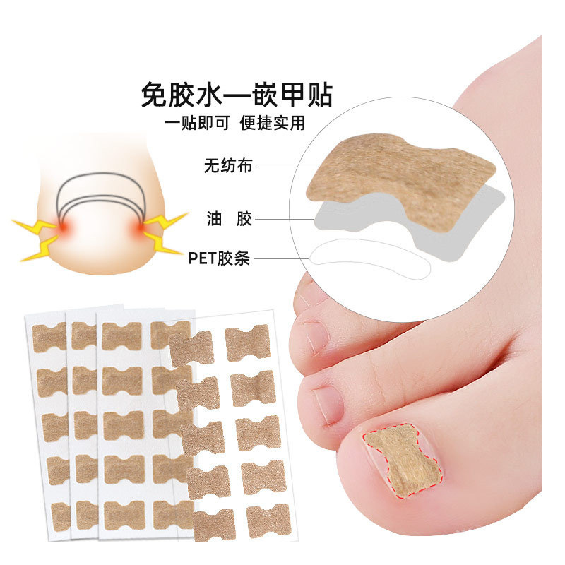 in stock nail stickers toenail nail straightener toenail long meat glue-free pull correction stickers