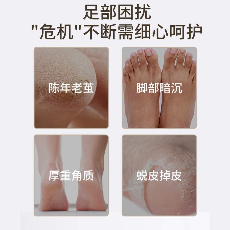 Factory Direct Sales Lannaseven Milk Exfoliating Foot Mask/Moisturizing Care 1 Pair/Bag Oil Control Refreshing Oil Control