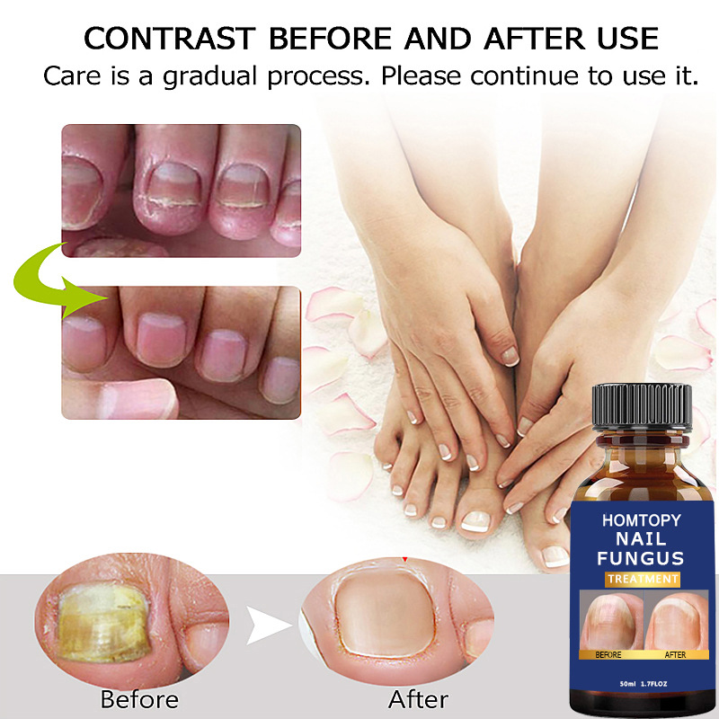 Cross-border new nail fungus repair nourishing liquid bright nail essence cleaning nail repair essence
