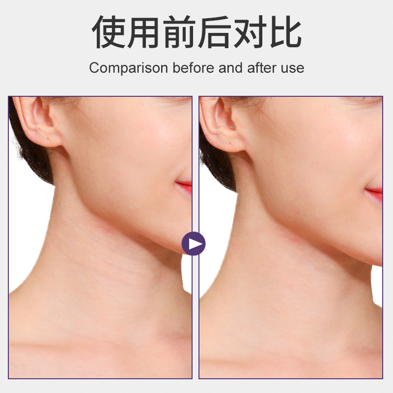Neck Texture Lifting Patch Firming Neck Invisible Breathable Office Portable Neck Skin Relaxation Lifting Bandage