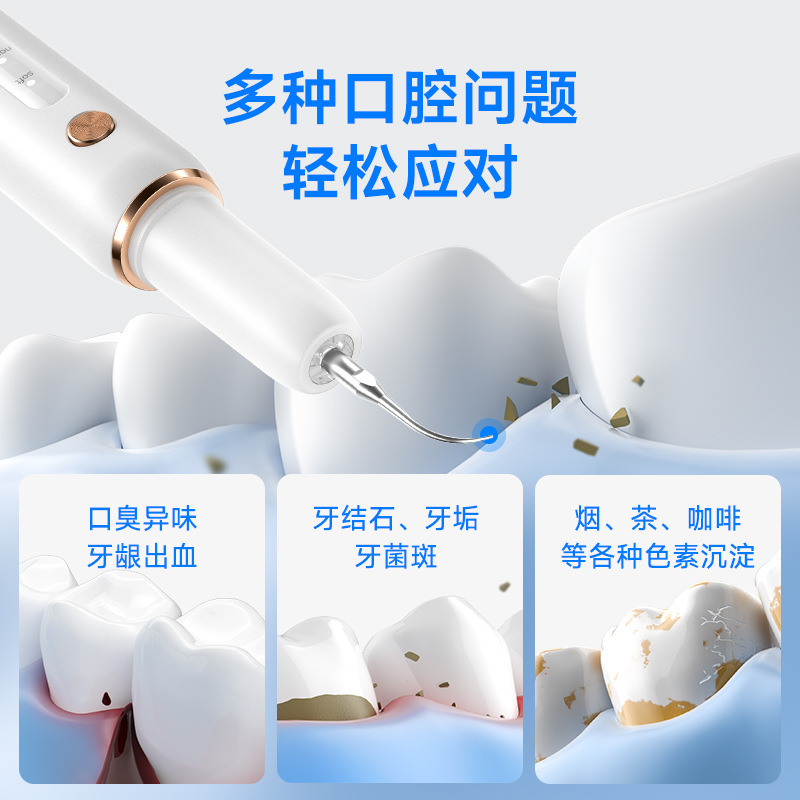 Manufacturer Wholesale Yue'Erwanwan Ultrasonic Dental Cleaning Machine for Removing Tartar, Dental Scaler, Braces Plaque Remover