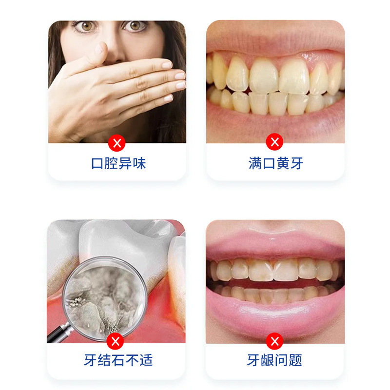 Hong Kong Pharmacy Dental Calculi Spray Smoke Stains Dental Plaque Clean Dental Plaque Remove Halitosis Dental Calculi Dental Plaque Smoke Stains