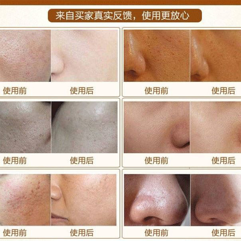 Pore Cleansing Cream gentle cleansing shrink pores blackhead removing acne cutin facial massage cream hair follicle Purifying Cream