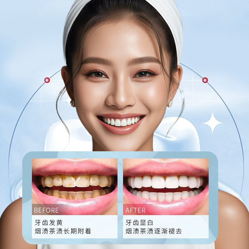 Teeth Whitening Gel Cross-Border Yellow Removal Artifact Tooth Essence Whitening Whitening Fresh Smoke Stain Removal Tooth Paste Gel
