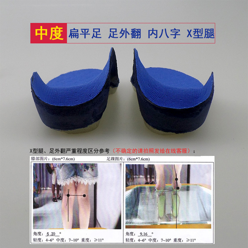 Children and Adults Flat Foot Pads for Foot Inversion Correction X-Shaped Legs with Flat Feet O-Shaped Legs with External Foot Pads