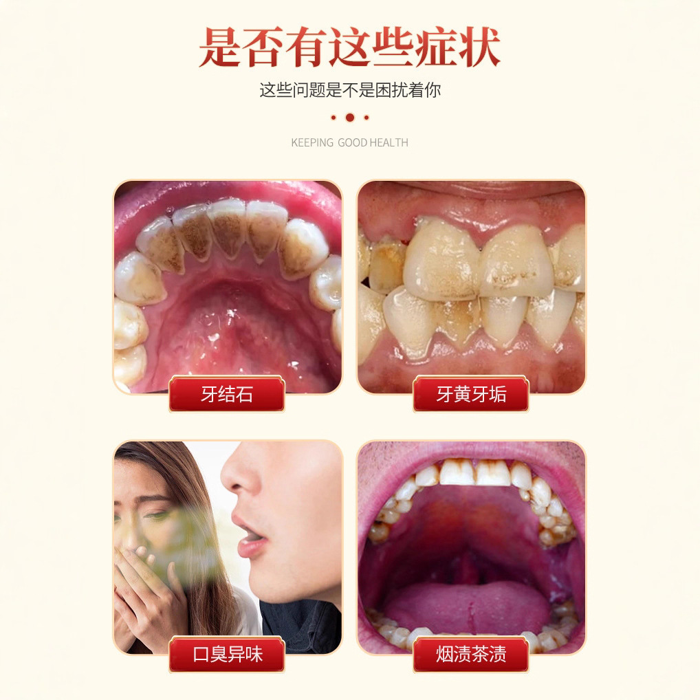 Hong Kong Pharmacy Dental Calculus Dissolving Spray Oral Odor Relief Gum Swelling Pain Sensitivity Tooth Protection in Stock