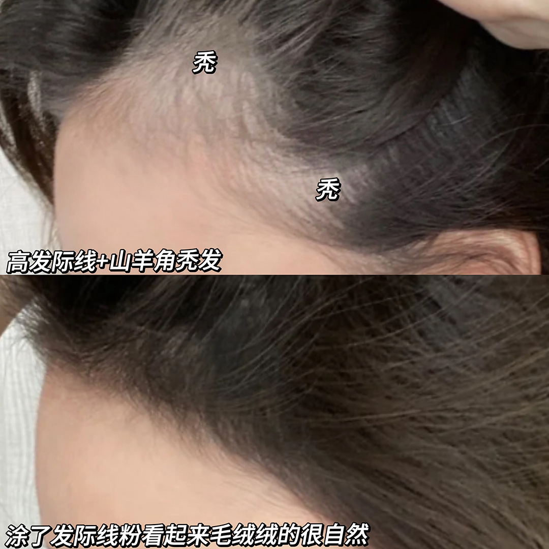 Gegebear Wu Zhongsheng Has Hairline Powder Mud Hairline Re-Hair Artifact Waterproof Shadow Repair Cross-Border