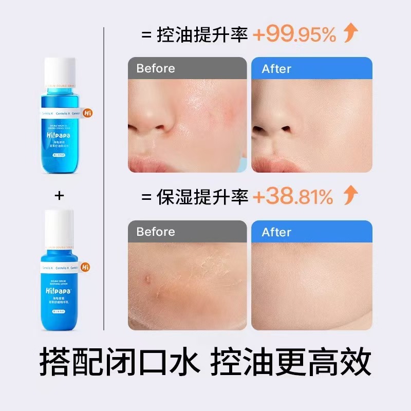 Turtle Dad Teenager Facial Cleanser Skin Care suit Boy Adolescent Female Student Oil Control Acne Cleanser