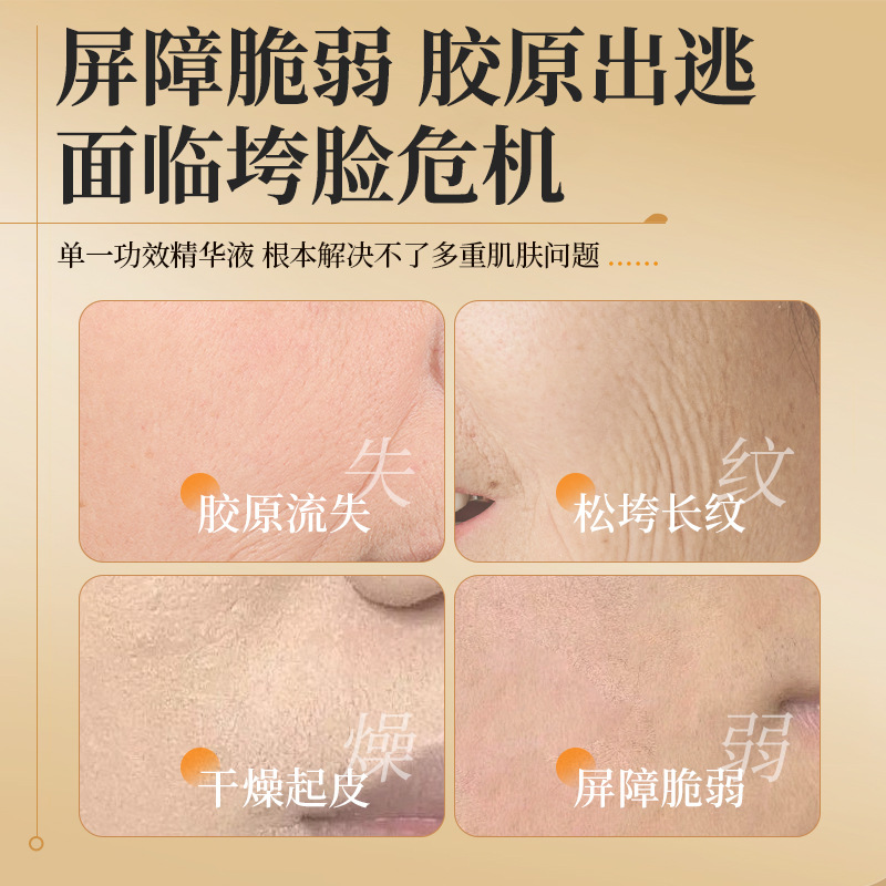 Shengfuda Placenta Collagen Anti-Wrinkle Firming Lightening Line Hydrating Second-Pulse Essence Skin Care Products