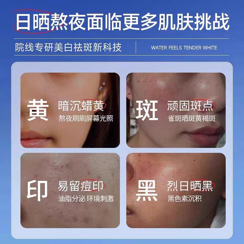 Beauty salon for whitening freckle kit chloasma freckle leather spot cream hospital line skin care products suit