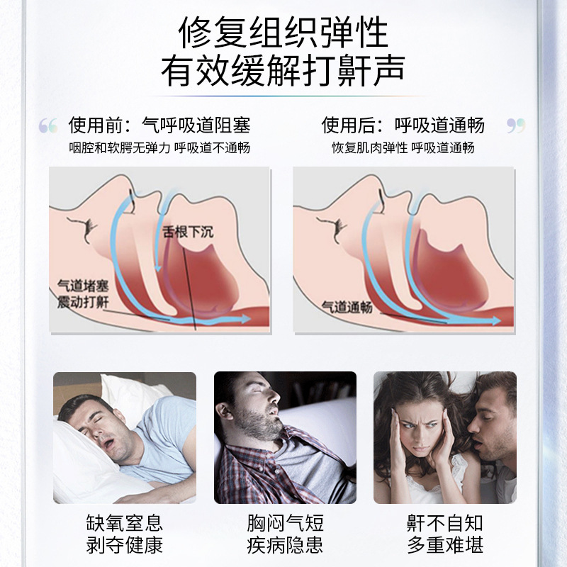 Take good care of good liquid snoring device 20ml new and old packaging alternate a generation of hair