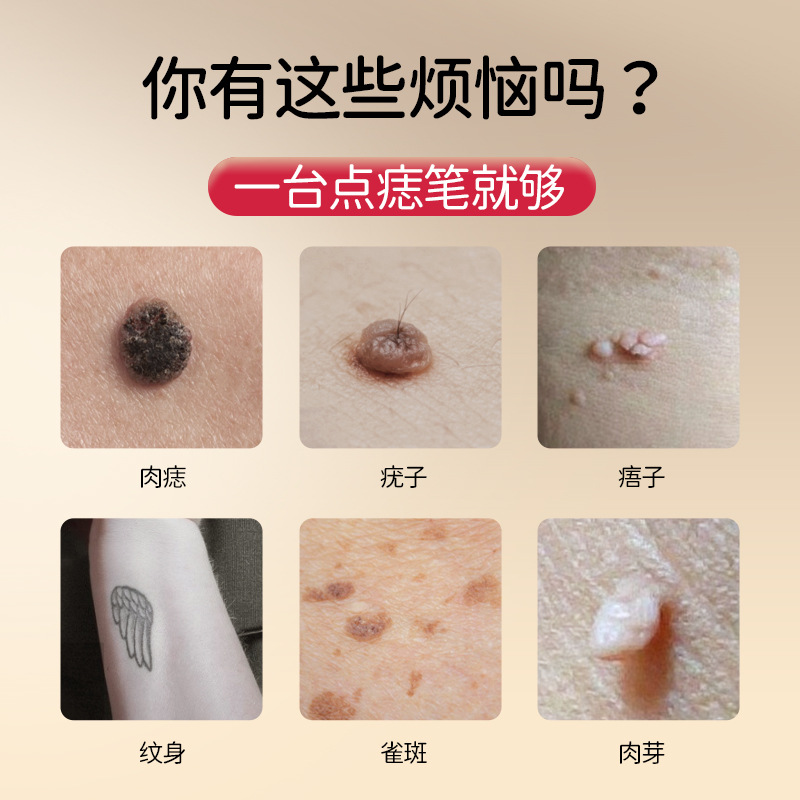 Cross-border Hot Sale Portable Painless Laser Dot Moles Instrument Handheld Electric Small White Dot Moles Pen Beauty Salon Instrument