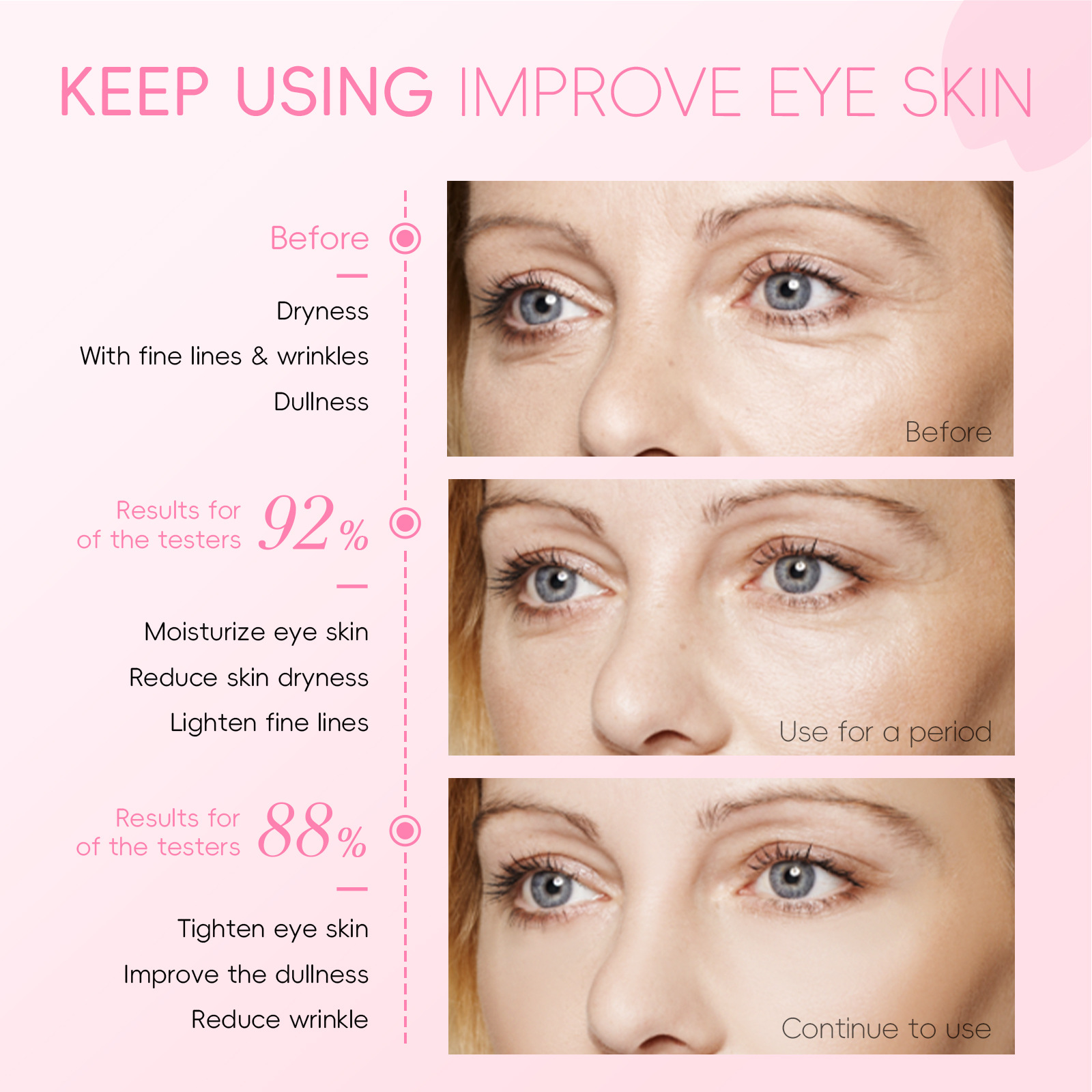 Manufacturer's Supply Cross-Border Fenyi Sakura Eye Essence 15ml Hydrating, Moisturizing, Caring for the Skin Around the Eyes and Moisturizing