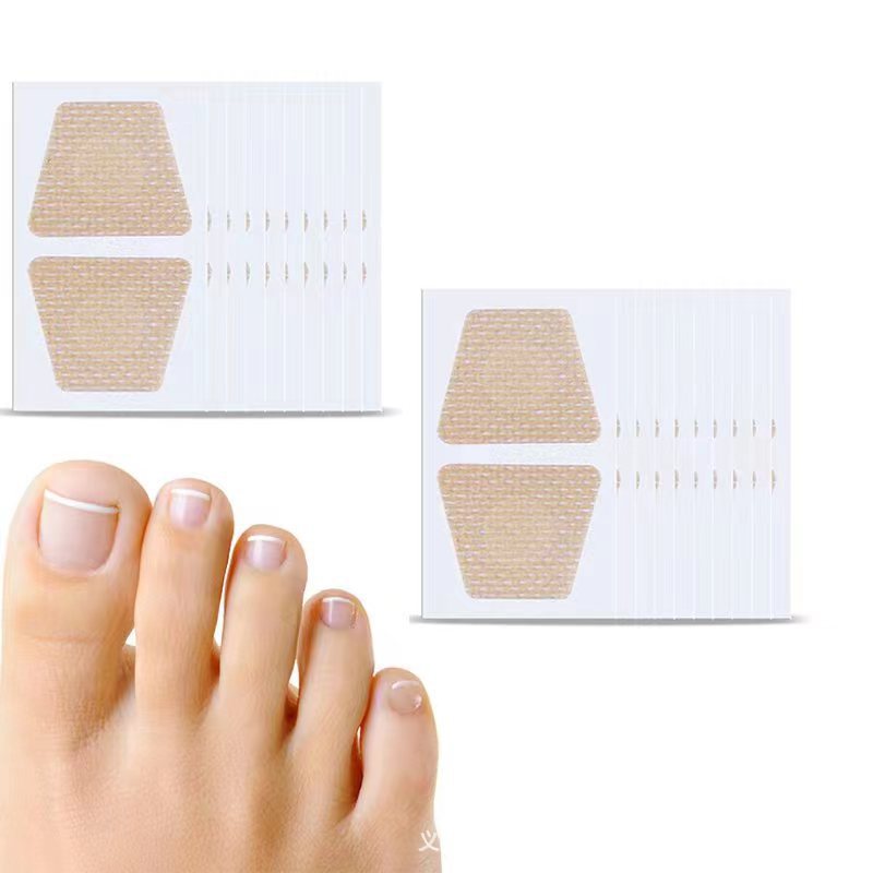 Breathable nail care patch inlay nail groove into the meat long toe pad soft nail onychomycosis nail repair patch orthopedic patch
