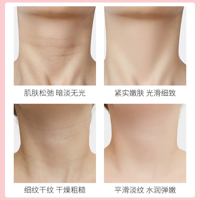 Han Lun Meiyu Goat's Milk Neck Film Patch Lever Tightening Small Iron Desalination Neck Cream Shake Tone with Spot