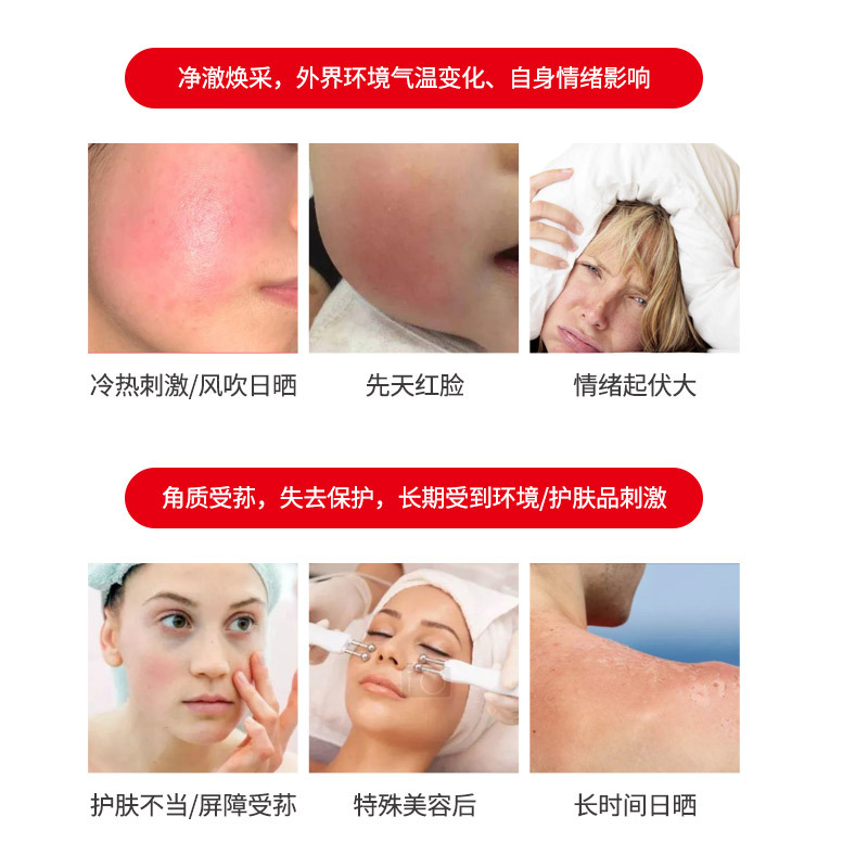 Lithospermum Skin Care Oil DIY Handmade Soap Lithospermum Ointment Raw Materials Warm and Nourishing Skin Care Plant Basic Base Oil