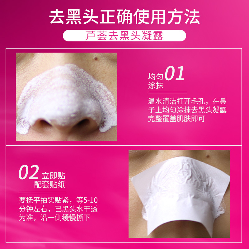 General trade Thailand blackhead removing water nose patch Garysoon white aloe vera gel unisex pig nose patch