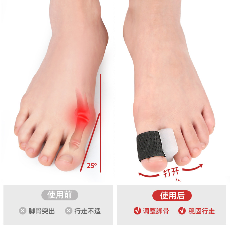 Thumb valgus orthosis big foot bone overlap toe separator SEBS soft stealth day and night wearable shoes