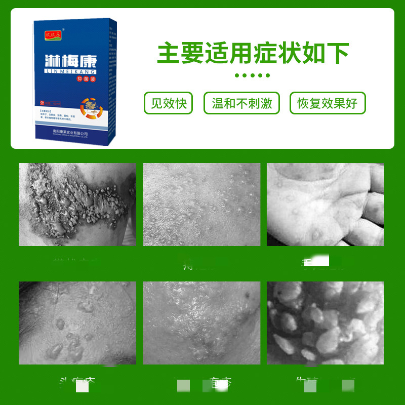 Manufacturer's Best-Selling Limeikang Spray 40ml Cleansing, Antibacterial, Disinfecting, Health Care, Family Personal Care, One Piece Delivery