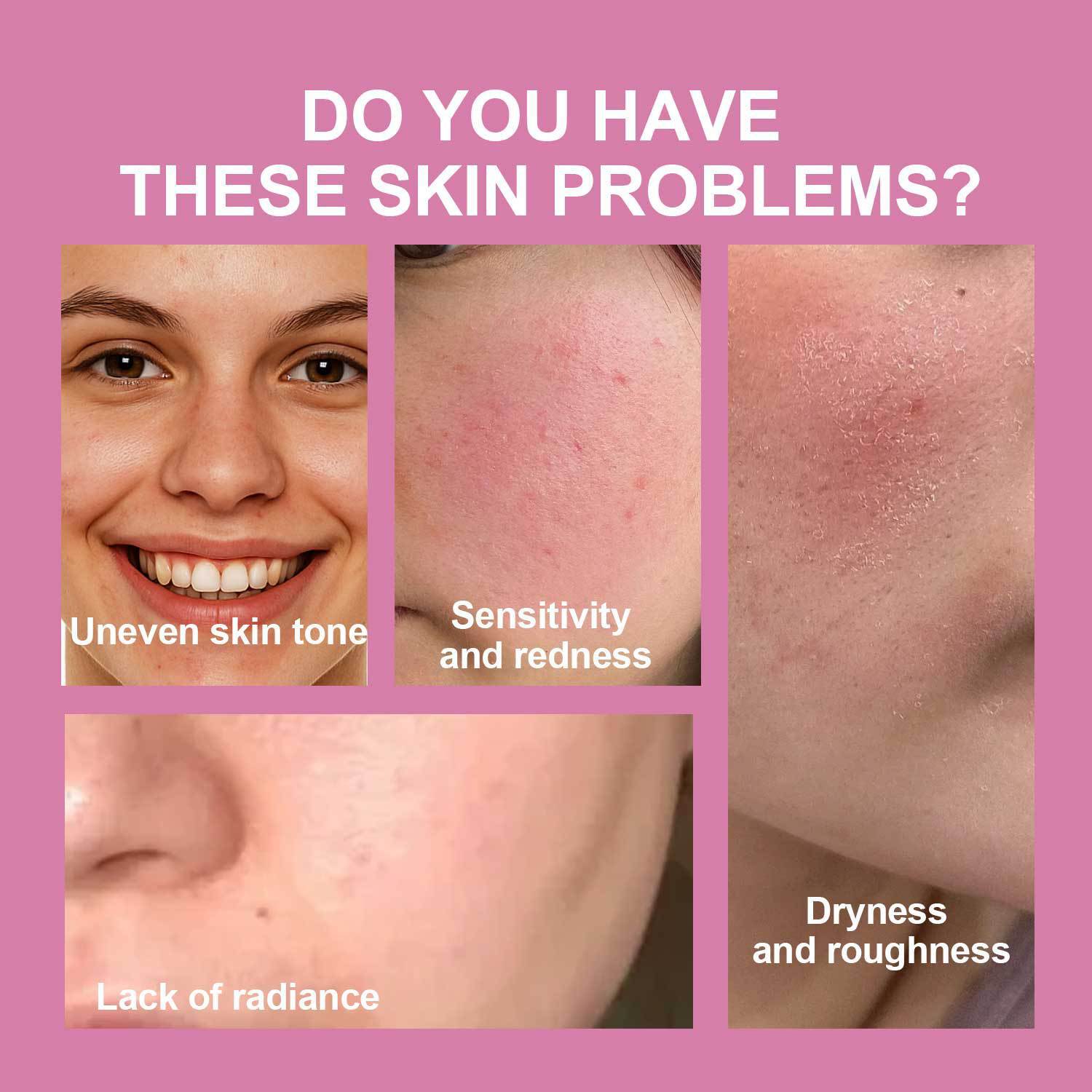 Cross-Border Peach 70% Niacinamide Essence Hydrating and Moisturizing Essence to Reduce Fine Lines Essence Liquid