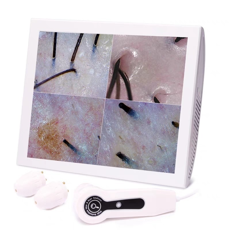 New upgraded HD 15 inch scalp detector hair loss hair follicle HD analyzer beauty salon hair tester