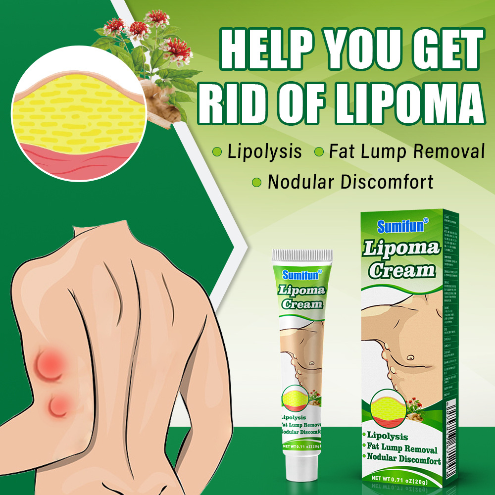 Sumifun Lipoma Cream Cross-border Lipoma Kang Cream Skin Moulds K10069