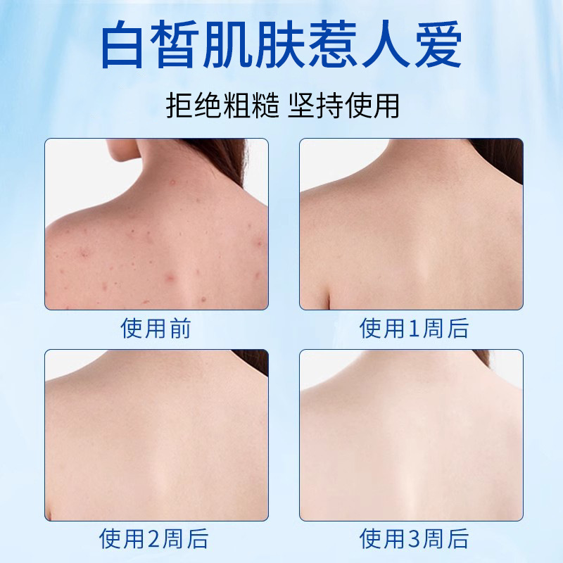 Genuine Rub Mud Treasure Bagged Bath Mud for Men and Women, Full Body Rub Mud Bath Baby Rub Bath Salt Bath Special Wholesale